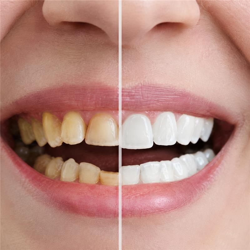 Dental Professional at work